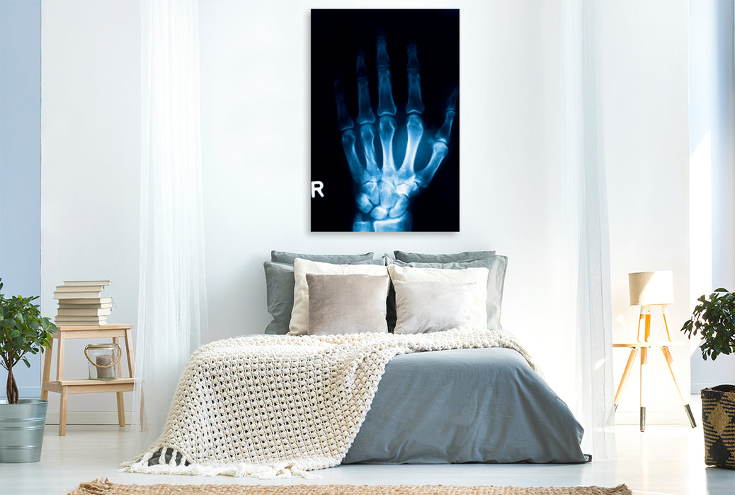 Premium Textil-Leinwand Premium Textil-Leinwand 80 cm x 120 cm  hoch Röntgenbild von einem Handknochen.