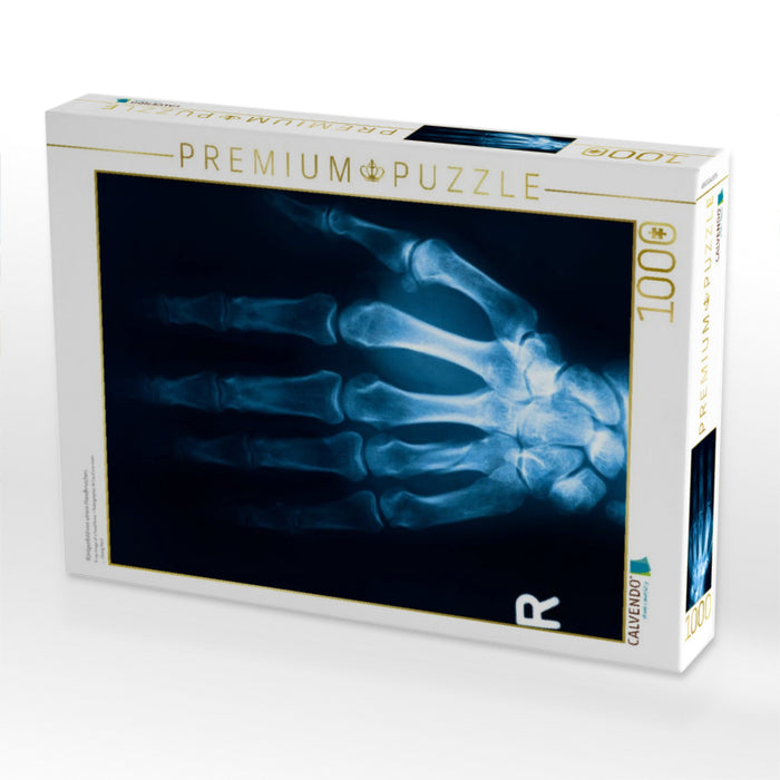 Röntgenbild von einem Handknochen. - CALVENDO Foto-Puzzle'