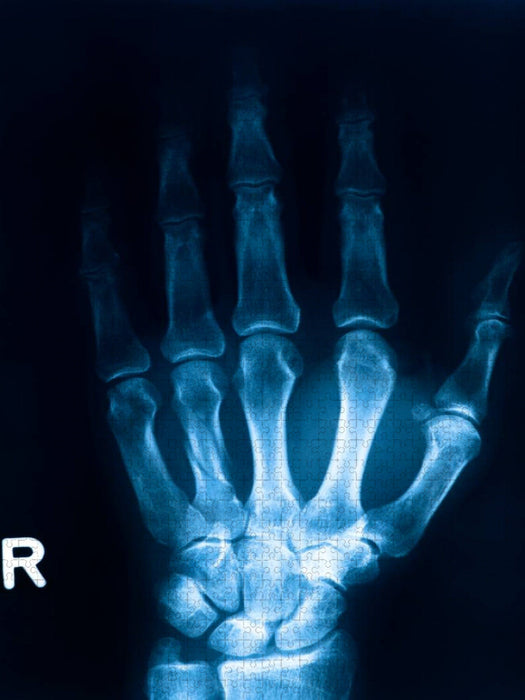 Röntgenbild von einem Handknochen. - CALVENDO Foto-Puzzle'