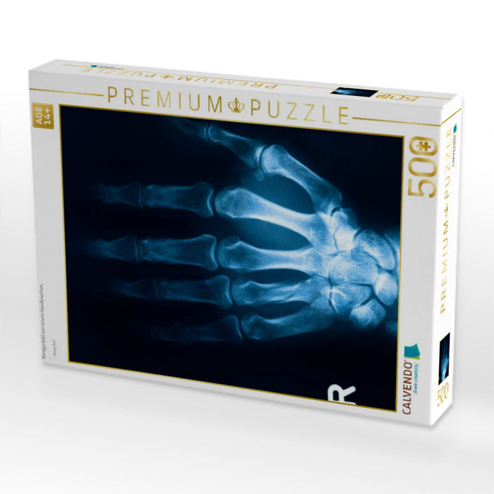 Röntgenbild von einem Handknochen. - CALVENDO Foto-Puzzle'