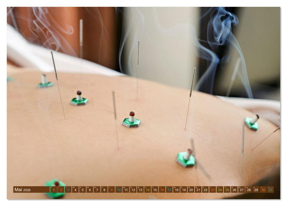 Akupunktur - Im Bann der Nadeln (CALVENDO Wandkalender 2026)