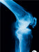 Röntgenbild von einem Kniegelenk. - CALVENDO Foto-Puzzle - calvendoverlag 29.99