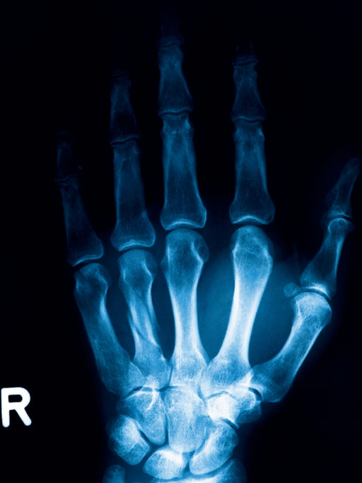 Röntgenbild von einem Handknochen. - CALVENDO Foto-Puzzle - calvendoverlag 29.99