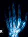 Röntgenbild von einem Handknochen. - CALVENDO Foto-Puzzle - calvendoverlag 29.99