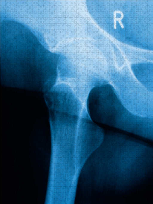 Röntgenbild vom Hüftgelenk einer Frau. - CALVENDO Foto-Puzzle - calvendoverlag 29.99