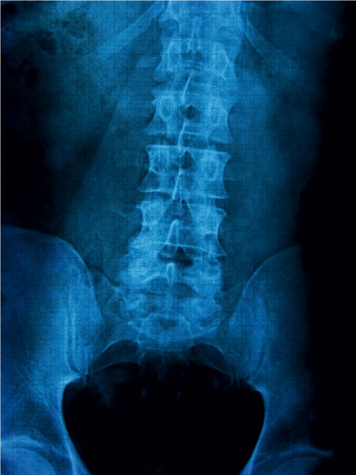 Röntgenbild einer Lendenwirbelsäule. - CALVENDO Foto-Puzzle - calvendoverlag 29.99