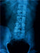 Röntgenbild einer Lendenwirbelsäule. - CALVENDO Foto-Puzzle - calvendoverlag 29.99