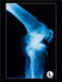 Seitenansicht eines Kniegelenks - CALVENDO Foto-Puzzle - calvendoverlag 29.99